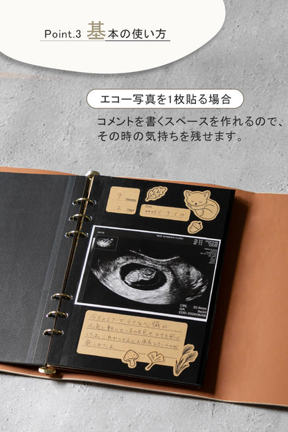 エコー写真アルバム