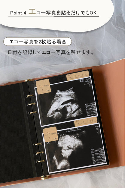 エコー写真アルバム
