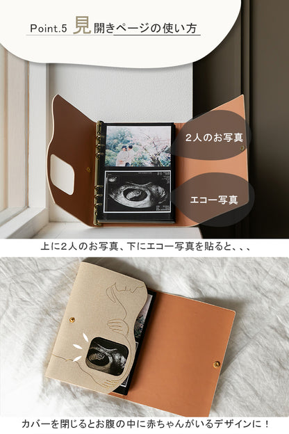 エコー写真アルバム