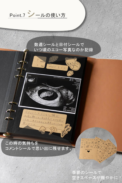 エコー写真アルバム